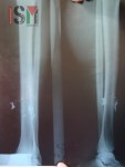 1-dumdum-xray-450×600