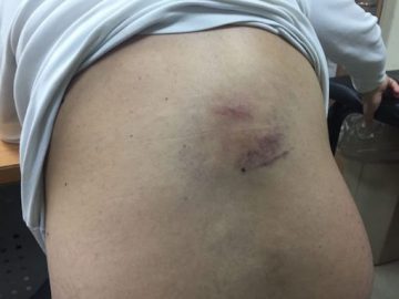 odeh-back-e1484846957383