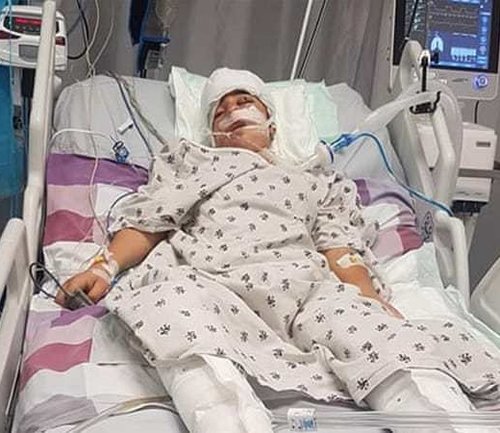  14-year-old Mohammad Tamimi spent 4 days in a medically-induced coma after being shot in the face by Israeli forces. 