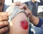 injuredfis-e1589276160952
