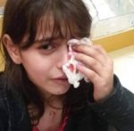 eyeinjured-e1591583401128