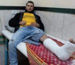 injuredworker-e1612856451839