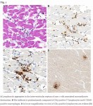 ximage-6.png.pagespeed.ic.dCt9_CmTq4