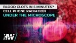 ptWKy.oq1b.2-small-BLOOD-CLOTS-IN-5-MINUTES-CE